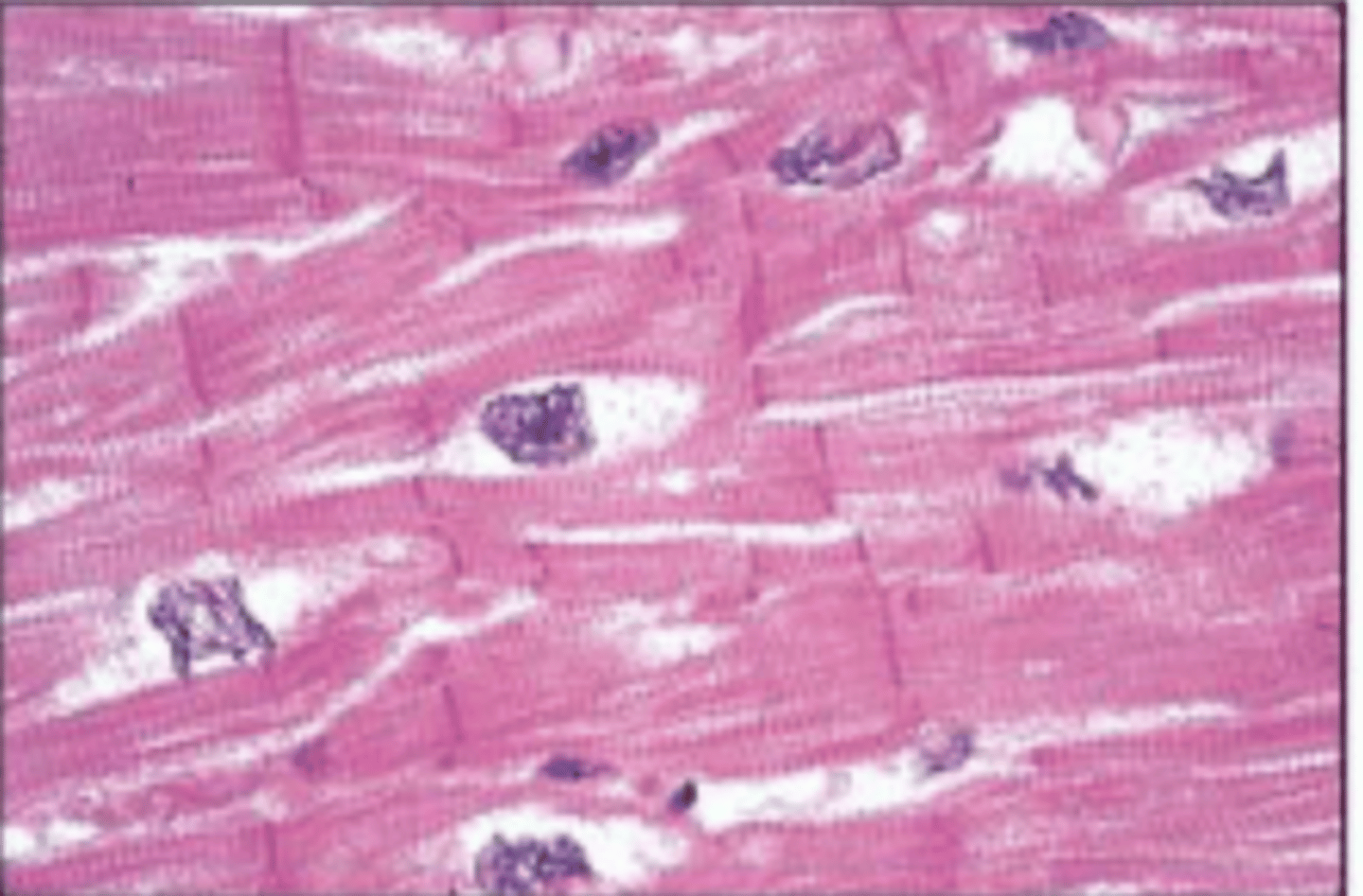 <p>Involuntary muscle tissue found only in the heart</p>