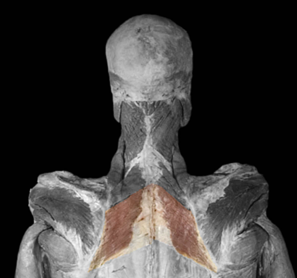 <p>What muscle is this? </p>