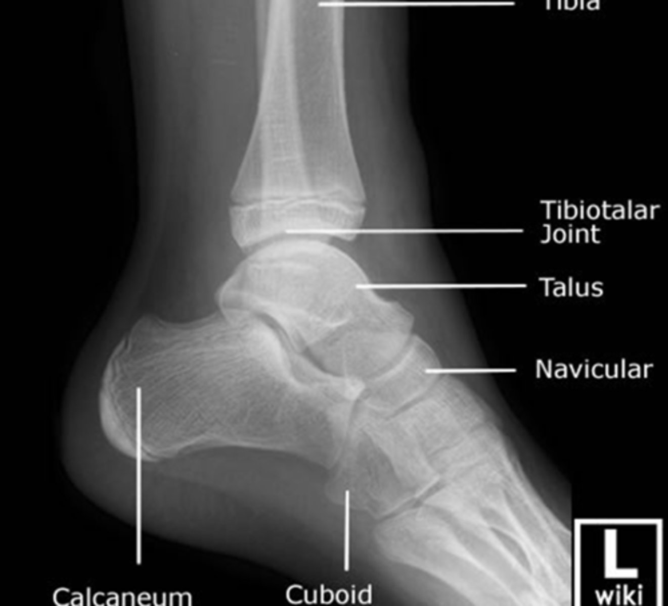 <p>Observe:</p><p>Fibula is superimposed behind the posterior tibia and talus</p><p>Anterior tubercle and posterior rim of the tibia are well demonstrated</p><p>Subtalar joint</p><p>Talus &amp; Calcaneus seen clearly and their articulations with the navicular and cuboid bones.</p>