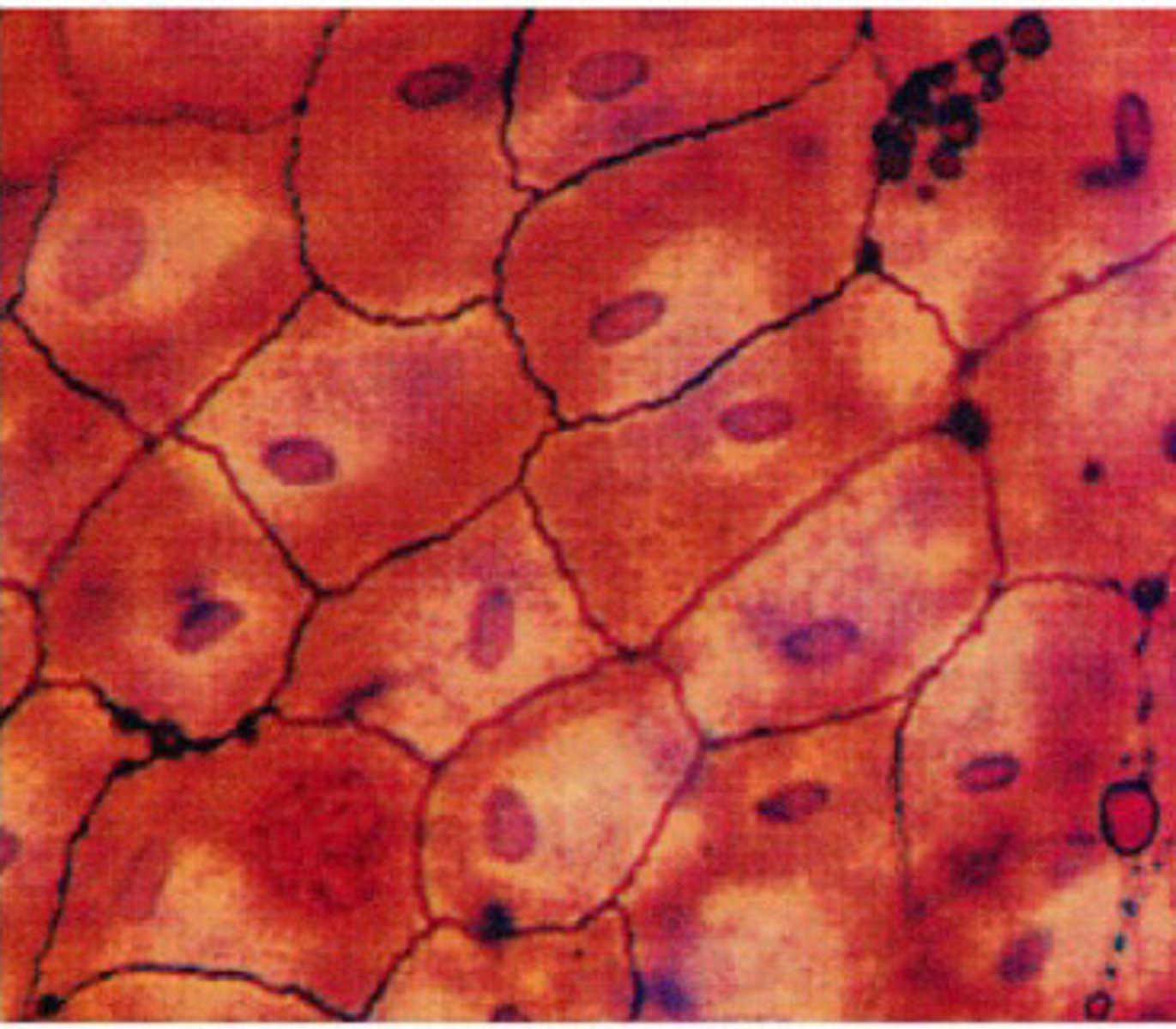 <p>Simple squamous epithelium</p>