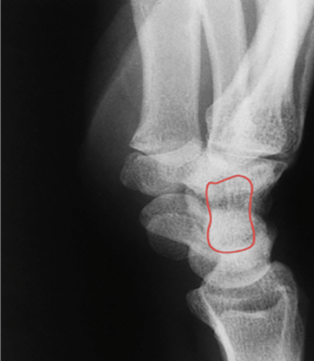 <p>What structure is highlighted?</p>