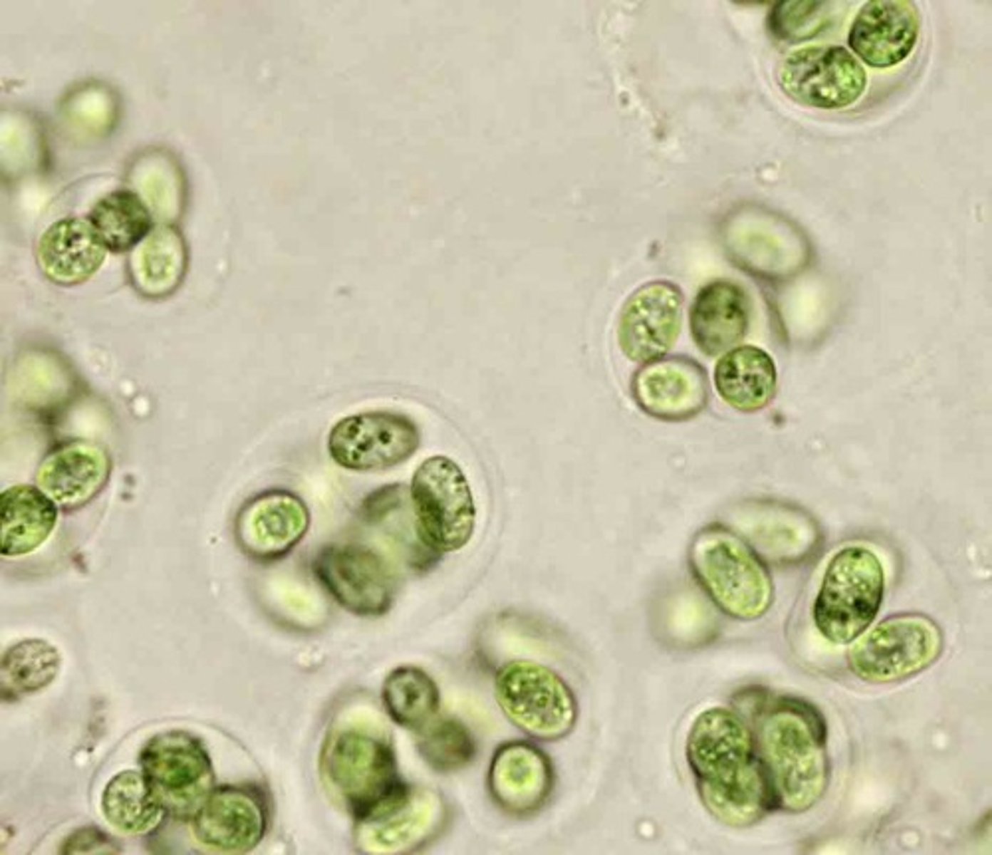 <p>Cyanobacteria; unicellular with gelatinous sheath surrounding cell; looks like clusters of colonies</p>