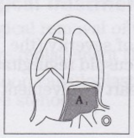 <p>Measured in <strong>AP4</strong> at end-systole by <u>tracing the LA inner border</u></p><p><sup> excludes area under MV annulus and inlet of Pv</sup></p>