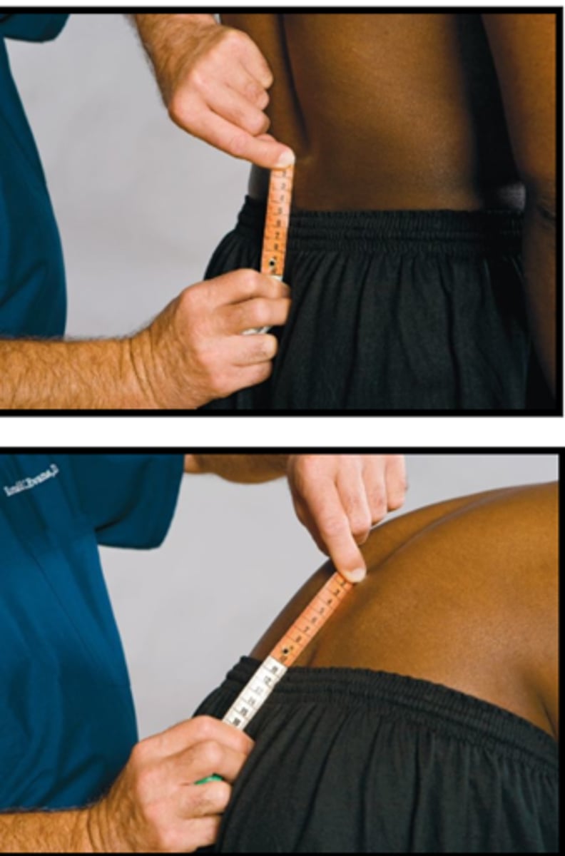 <p>Assessment for:</p><p>- Lumbar spine motion</p>