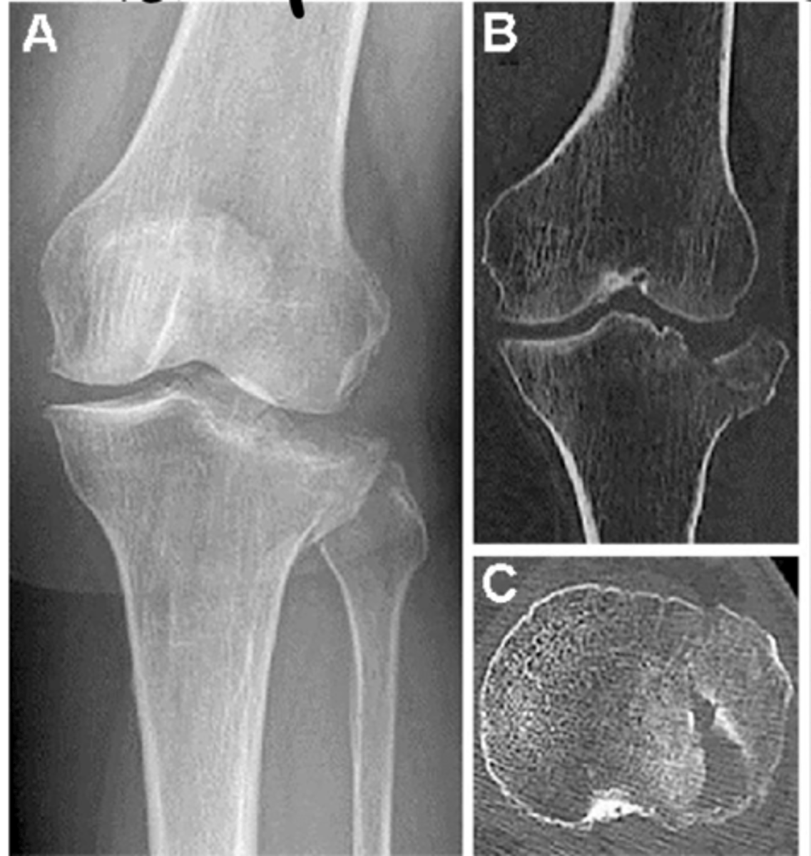<p>Define the pathology.</p>