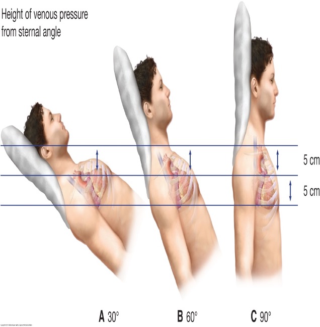 <p>cannot be measured bc meniscus is above jaw line </p>