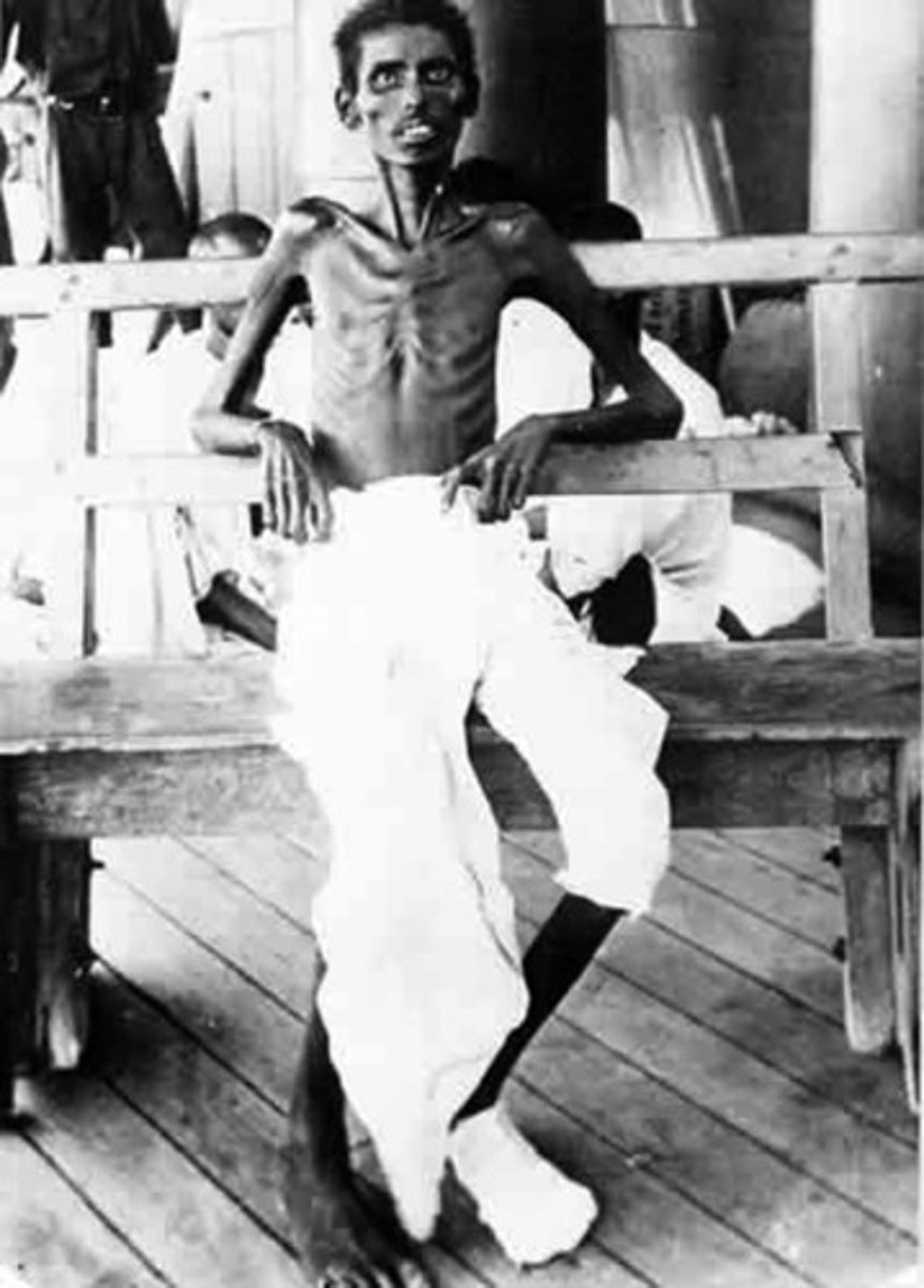 <p>(adj., part.) unnaturally thin</p><p>synonyms: withered, shriveled</p><p>antonyms: plump, fat, obese, corpulent</p>