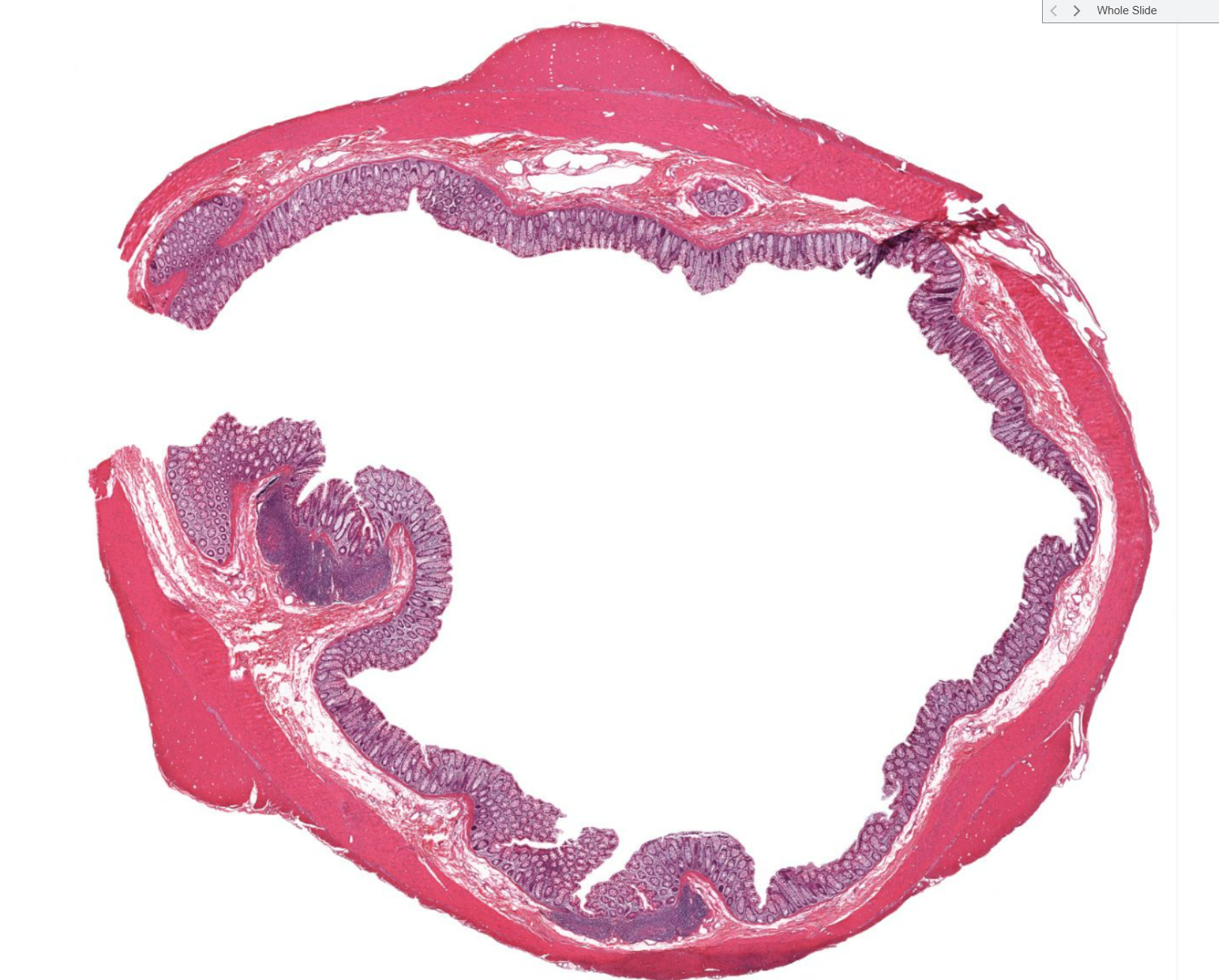 <p>Organ?</p><p>Bump looking structure on outside? Found where?</p>