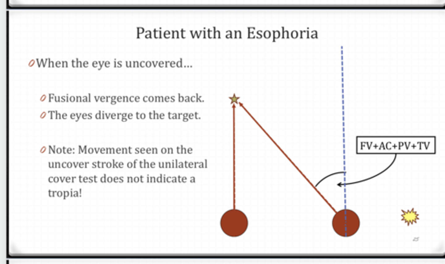 <p>Patient with an ESOphoria Example</p><p>When the eye is uncovered what happens?</p>