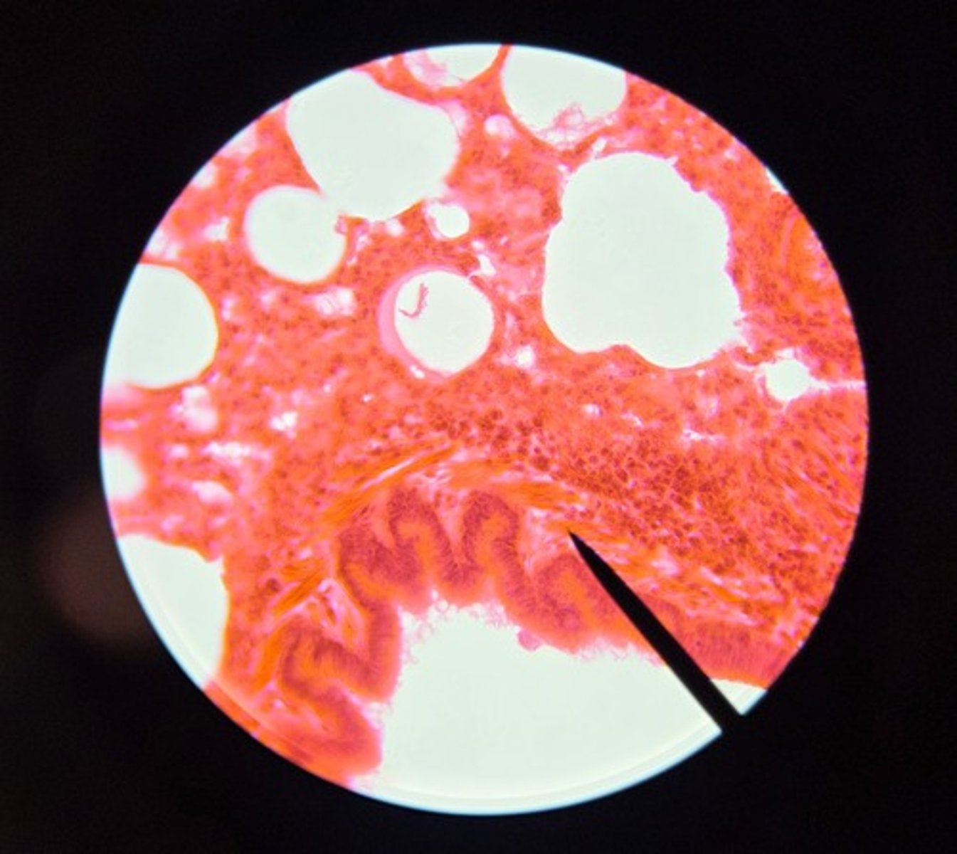 <p>What is being pointed at? (It's the little strands of tissue above the epithelium)</p>