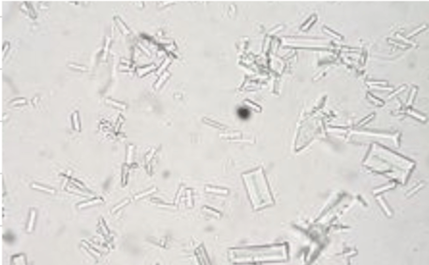 <p>hypersaturation of mineral contents in the urine. usually caused by poor diet, although some breeds are predisposed.</p>