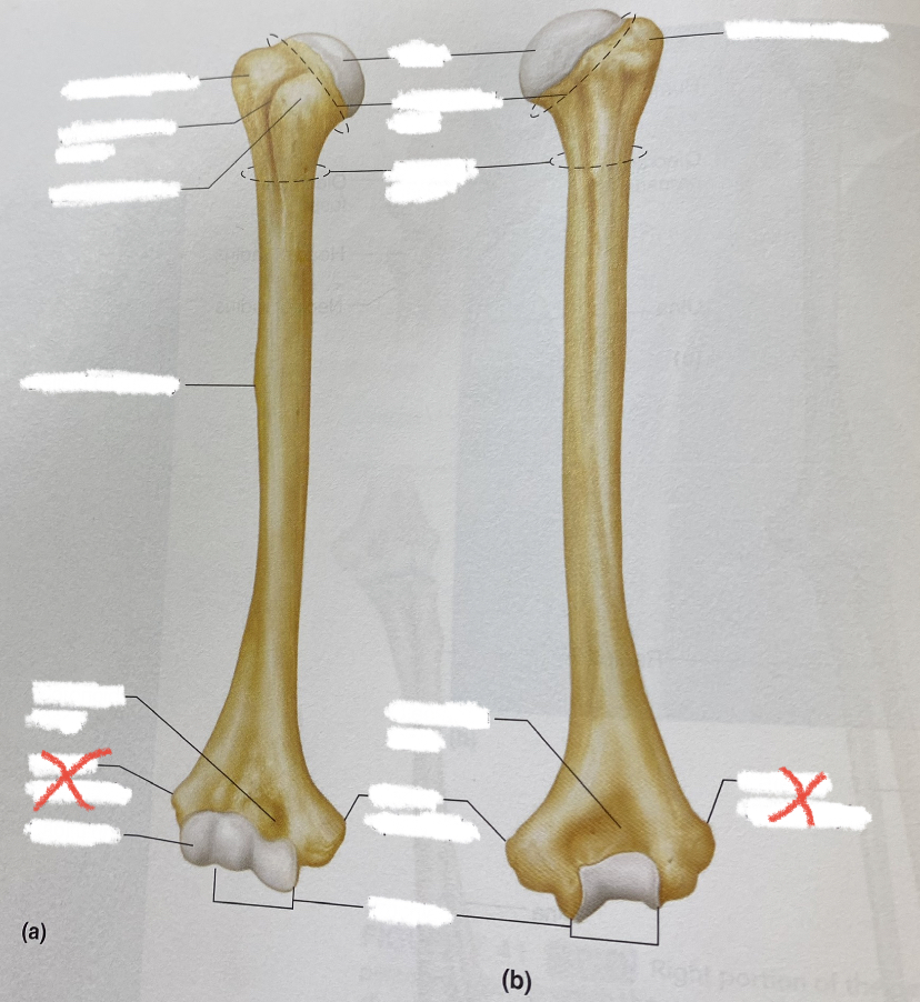 common fractures here