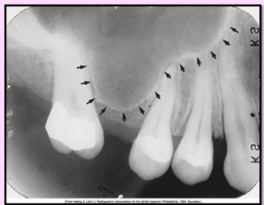 <p>What is the name of this bony landmark?</p>