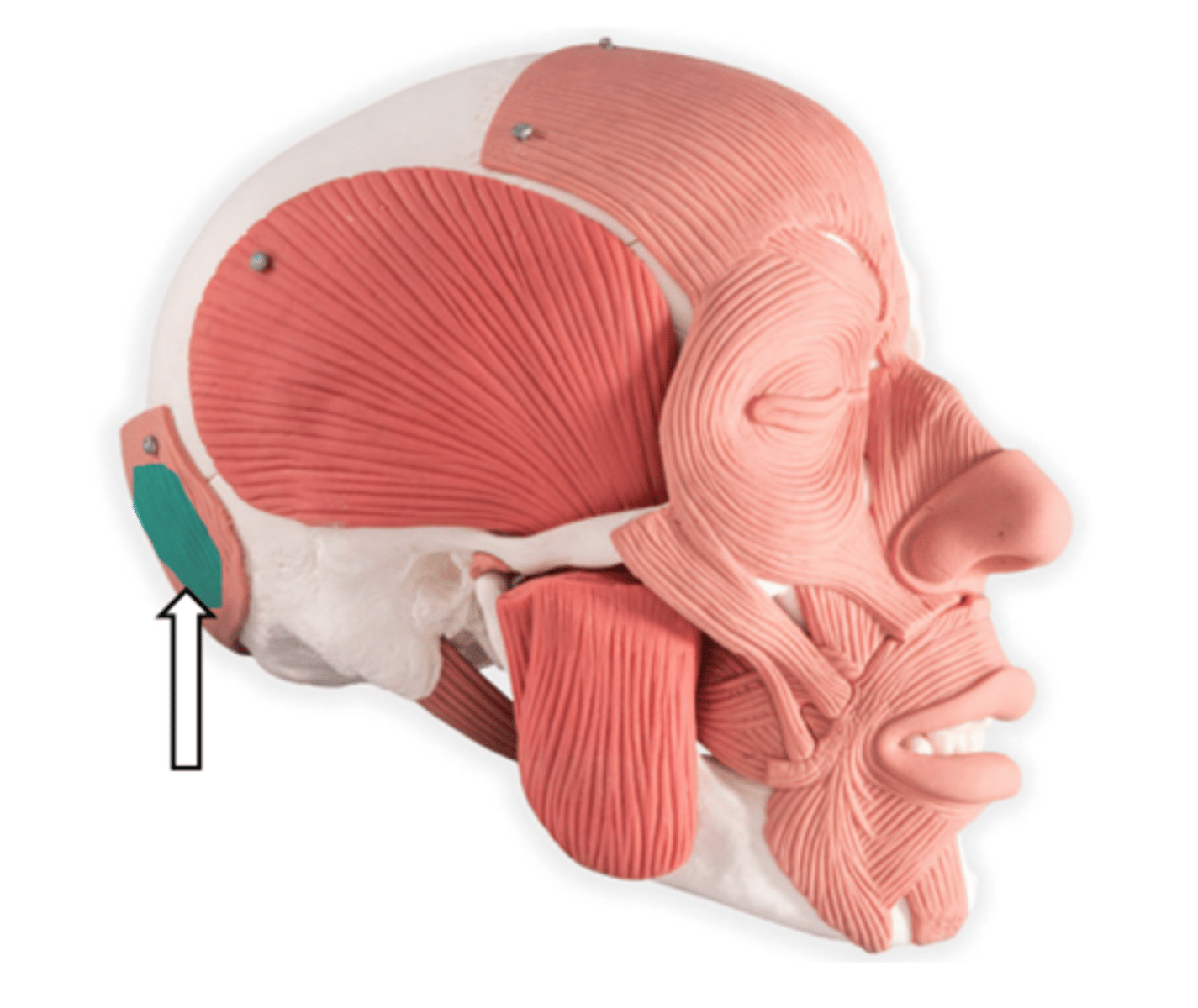 <p>name the part</p>