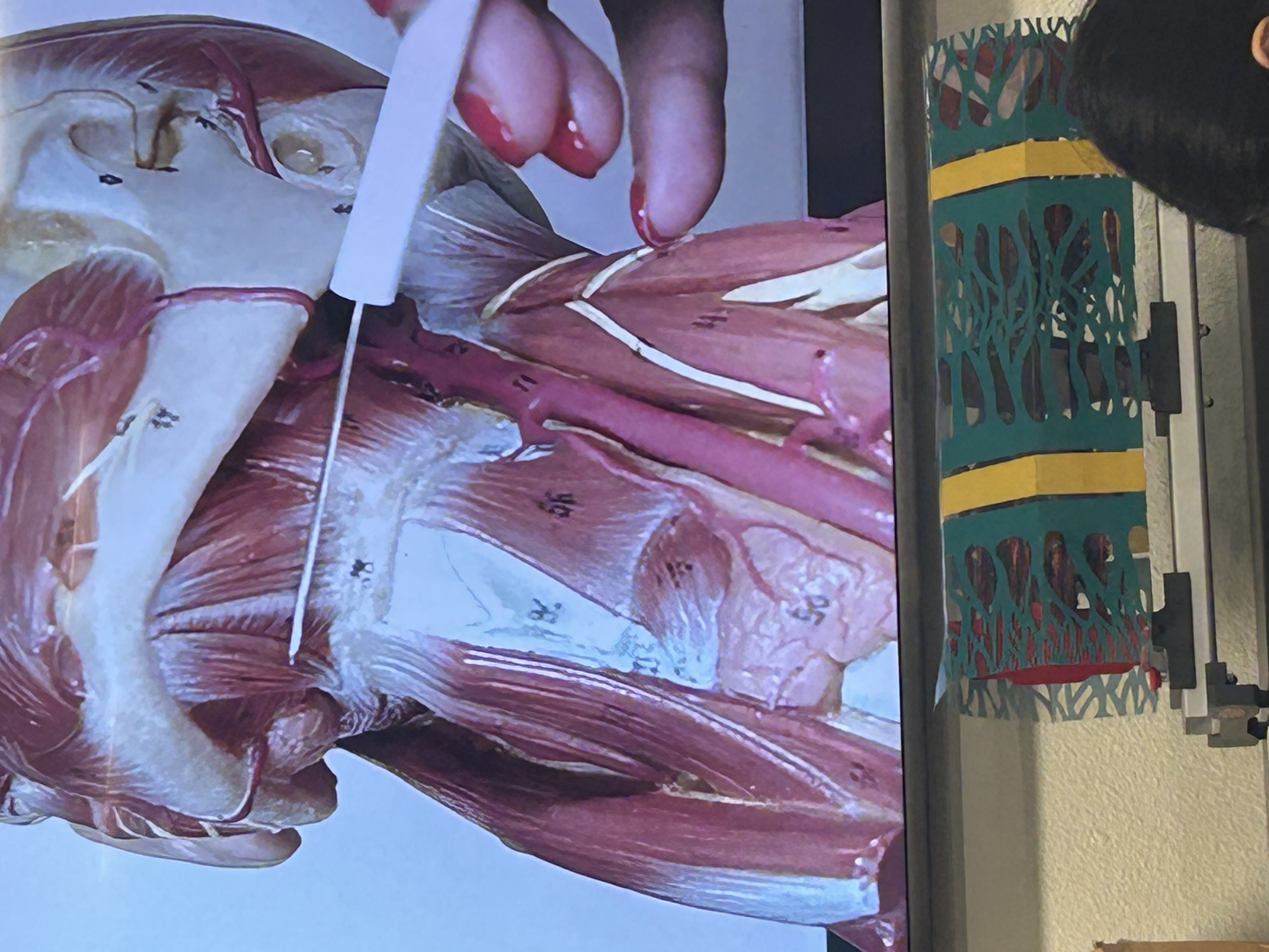 <p>What muscle is this?</p>