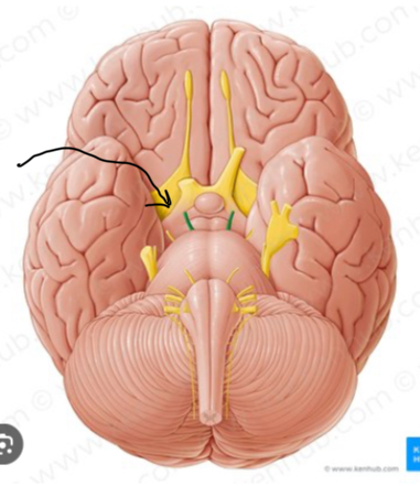 knowt flashcard image