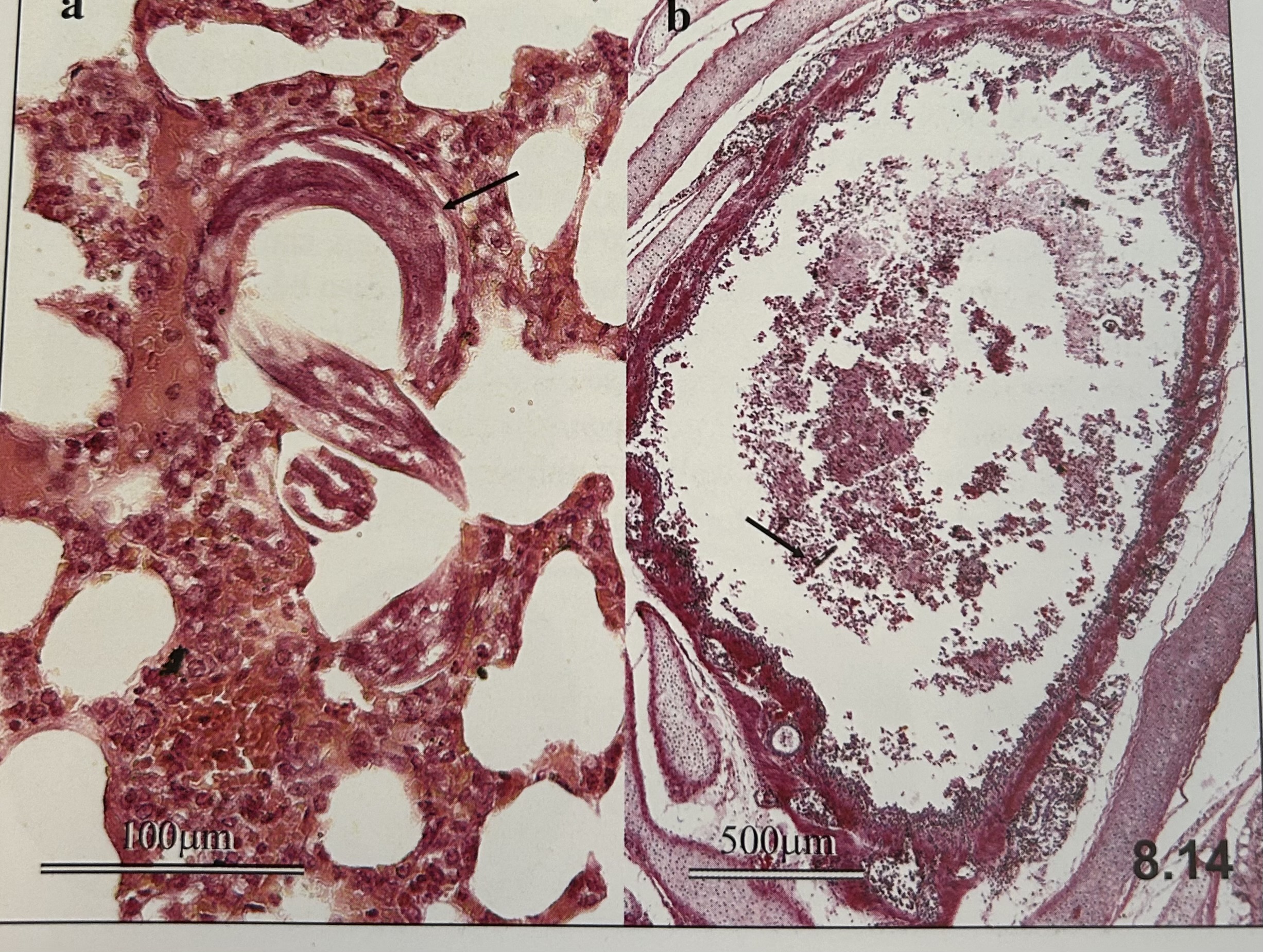 <p>characteristics of </p><p>Ascaris lumbricoides (larvae in lungs)?</p>
