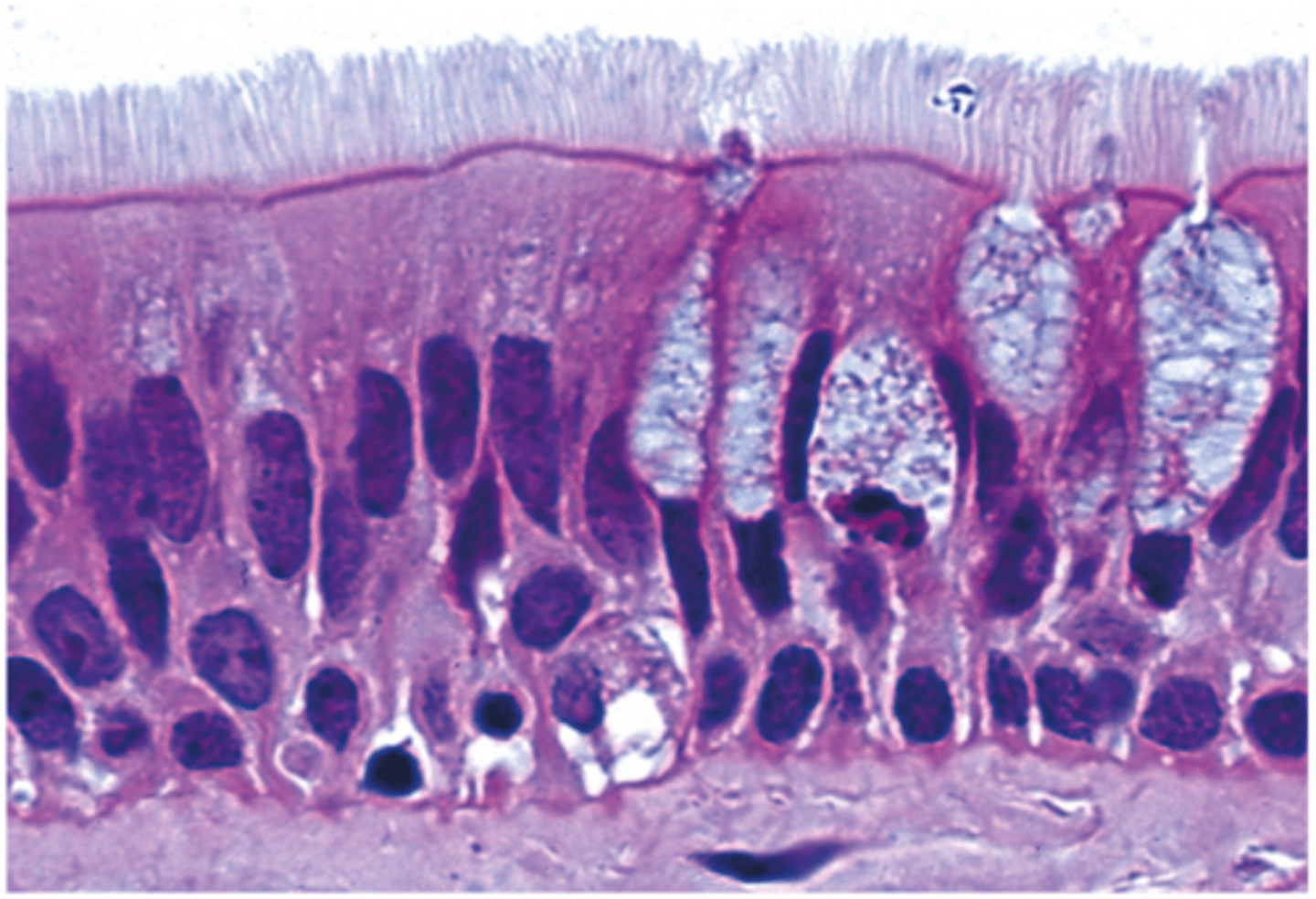 <p>Pseudostratified Columnar</p>
