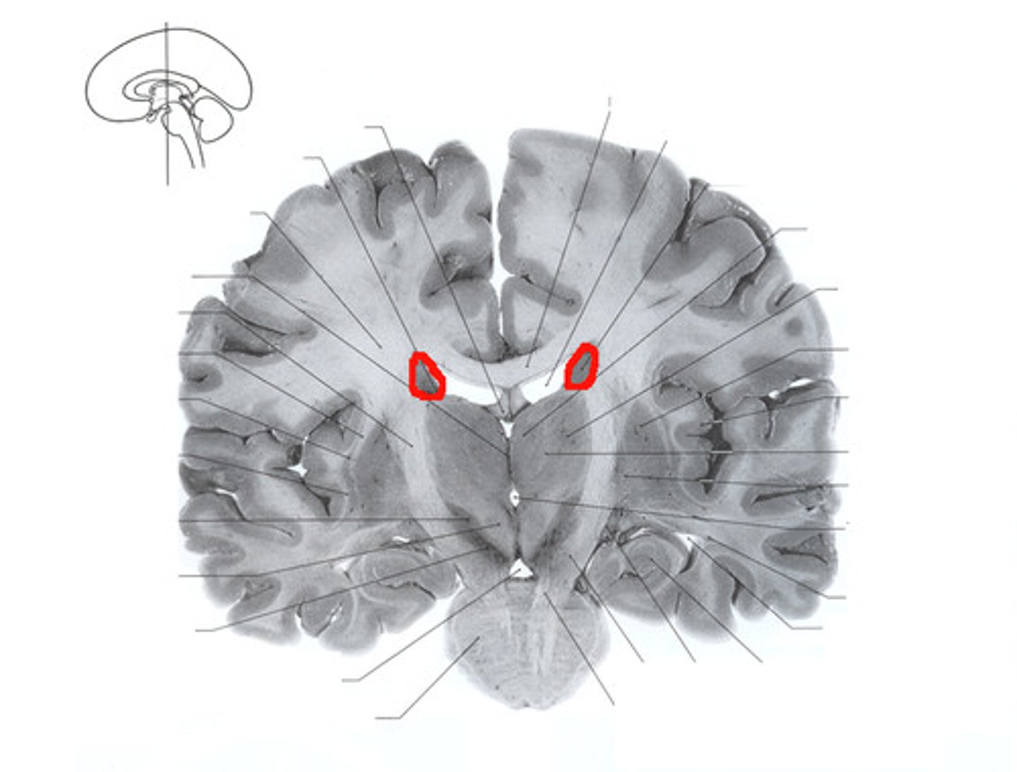 <p>deep brain nuclei with a head and tail end, most lateral to the other basal nuclei</p>