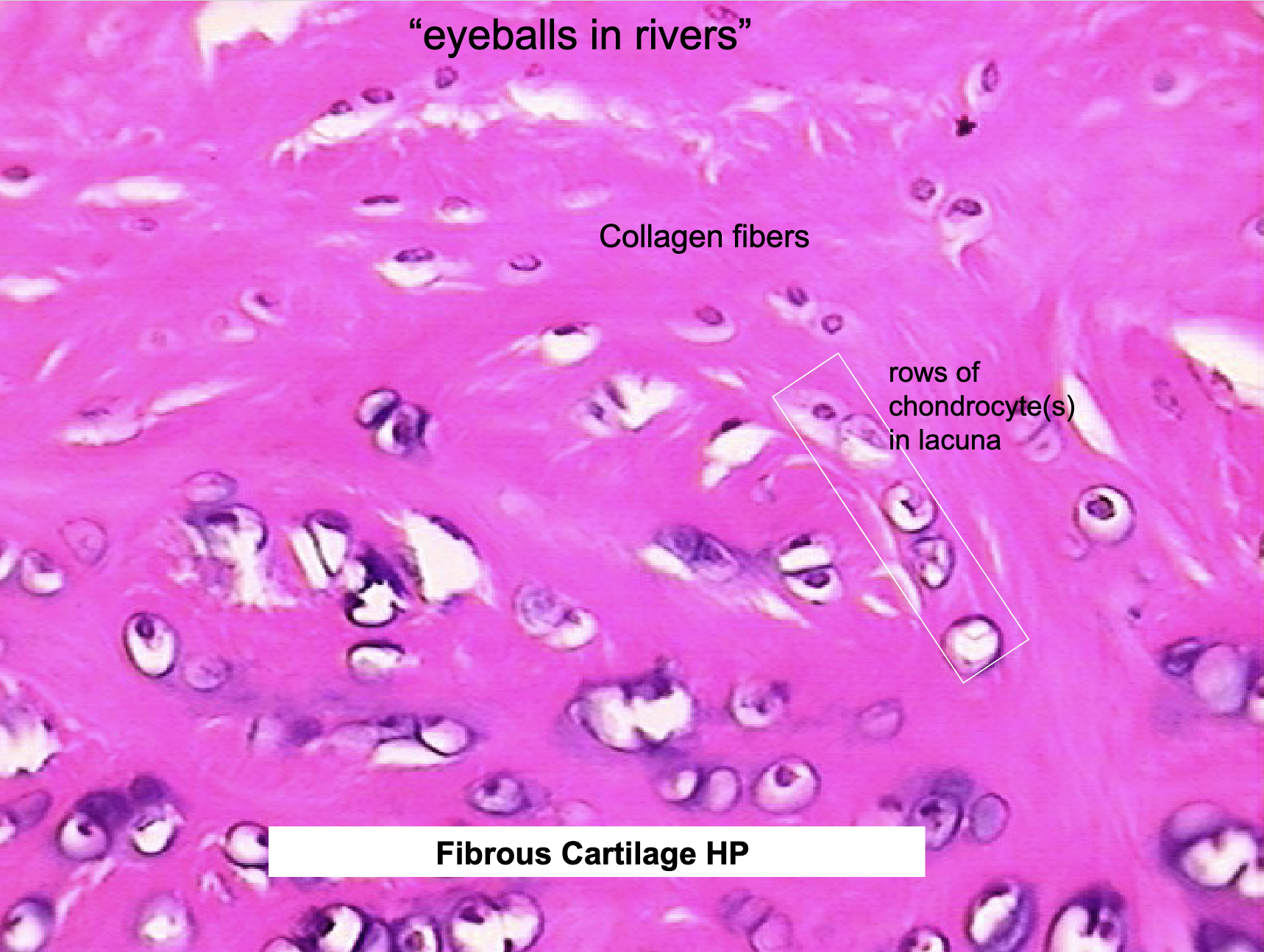 <ul><li><p>pubic symphysis, intervertebral disks, knee joint</p></li><li><p>resists compression</p></li></ul><p></p>