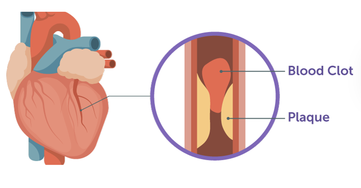 <p>Maintaining CV Function</p>