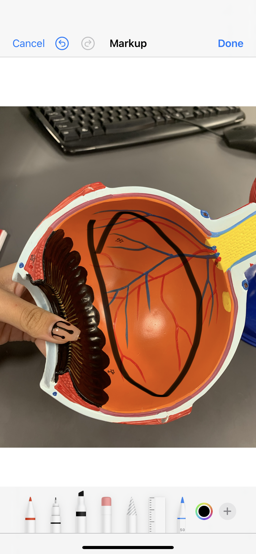 <p>the orange in eye </p>