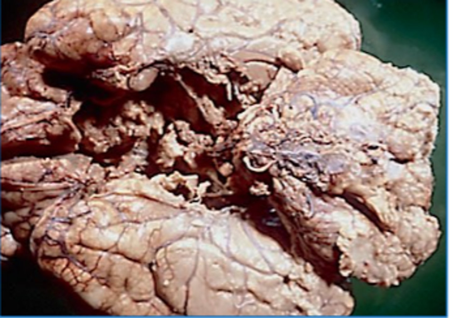 <p>Define Respirator brain</p>