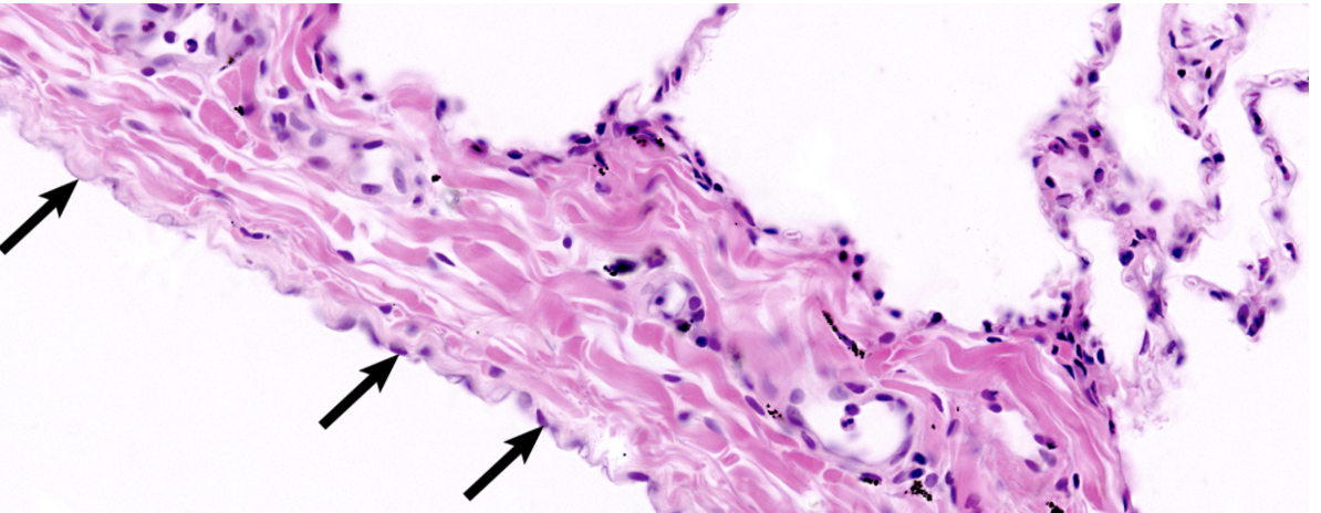 <p>What type of tissue is the black arrows pointing to?</p>