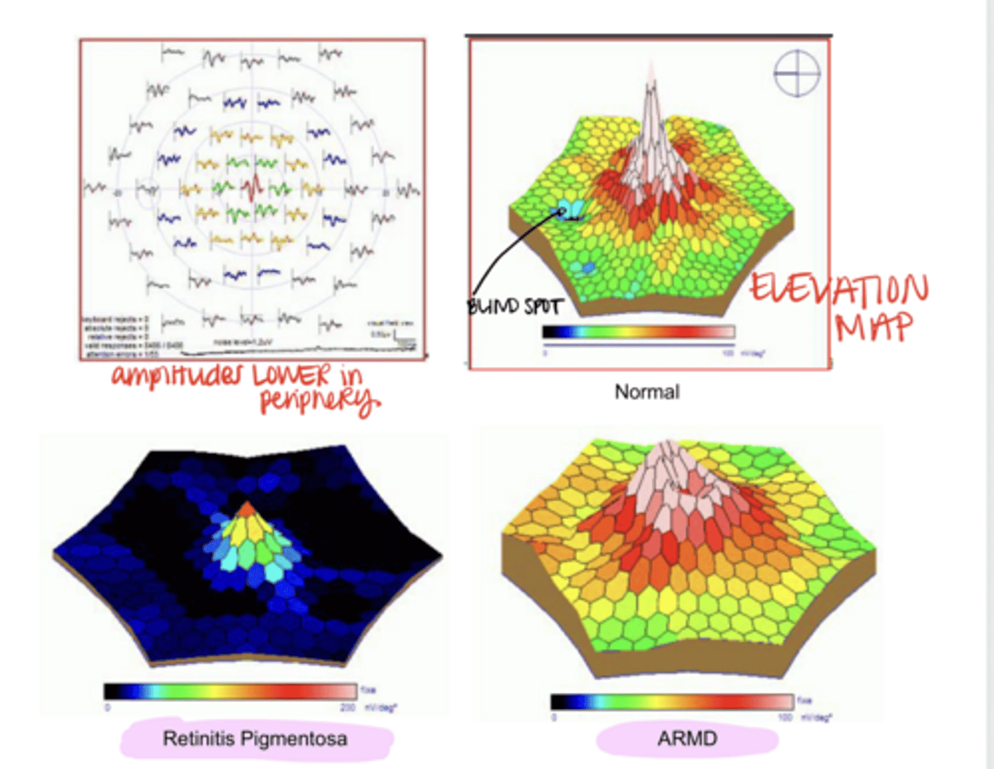 <p>Are the waveforms that are generated by the mfERG of multi-focal ERG actual direct electrical recordings?</p>