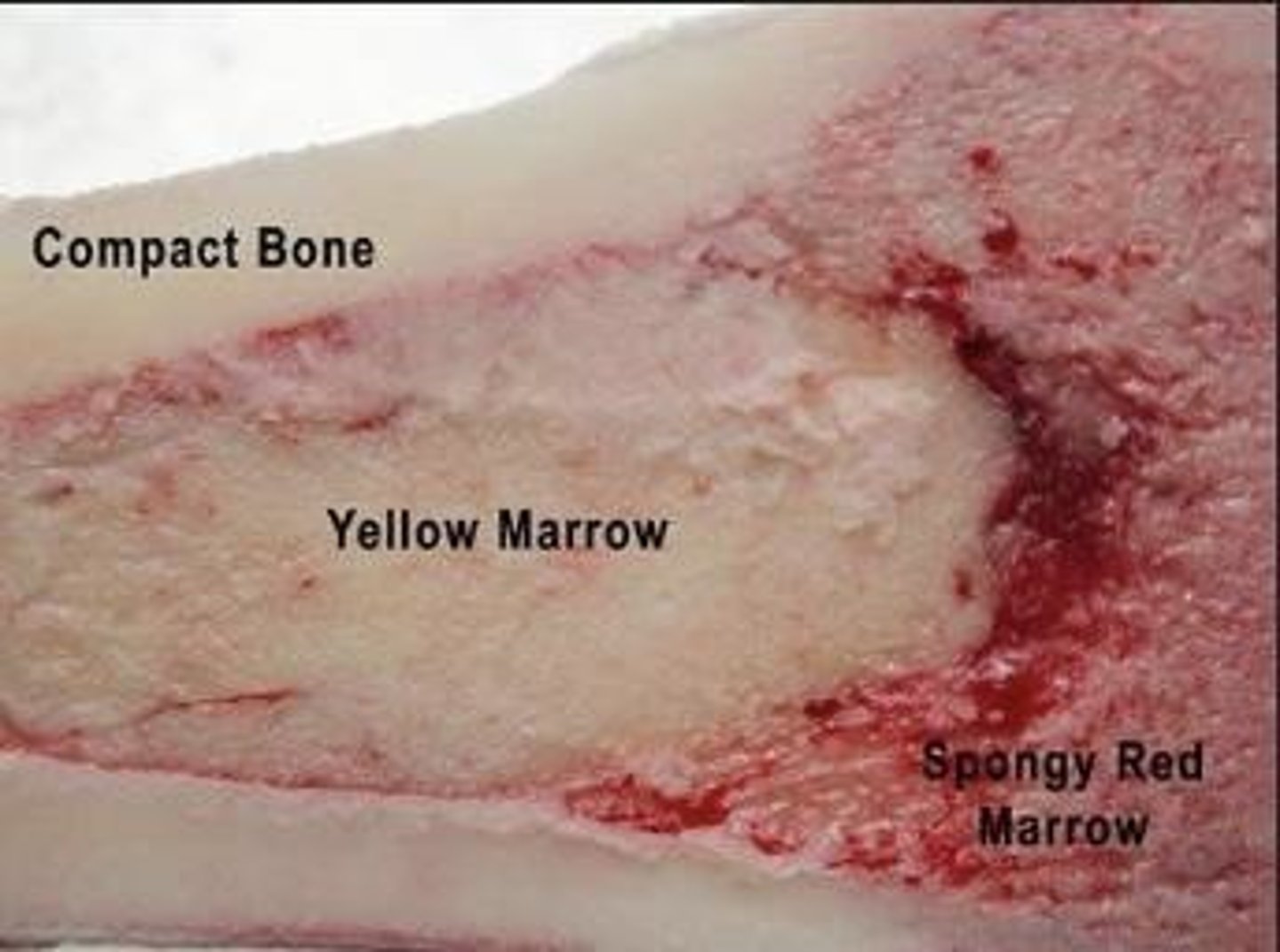 <p>Fat storage within the medullary cavity.</p>
