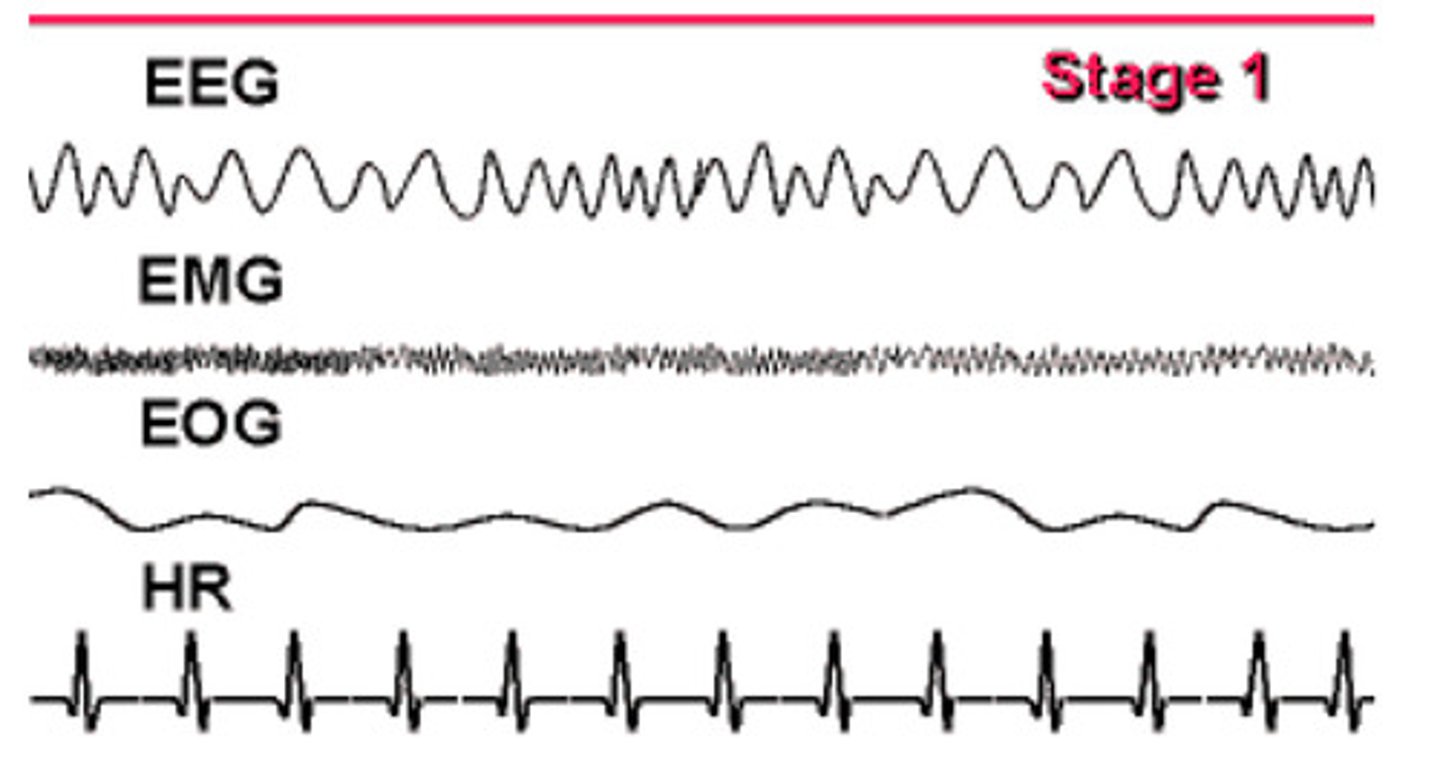 <p>- lasts 5-10 minutes</p><p>- theta waves</p>