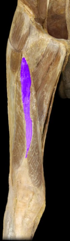 <p>Name the muscle highlighted (two words - all lowercase)</p>