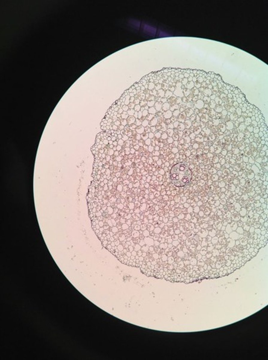 <p>-the xylem is star-shaped with several radiating arms</p><p>-The phloem is located between the radiating arms.</p>