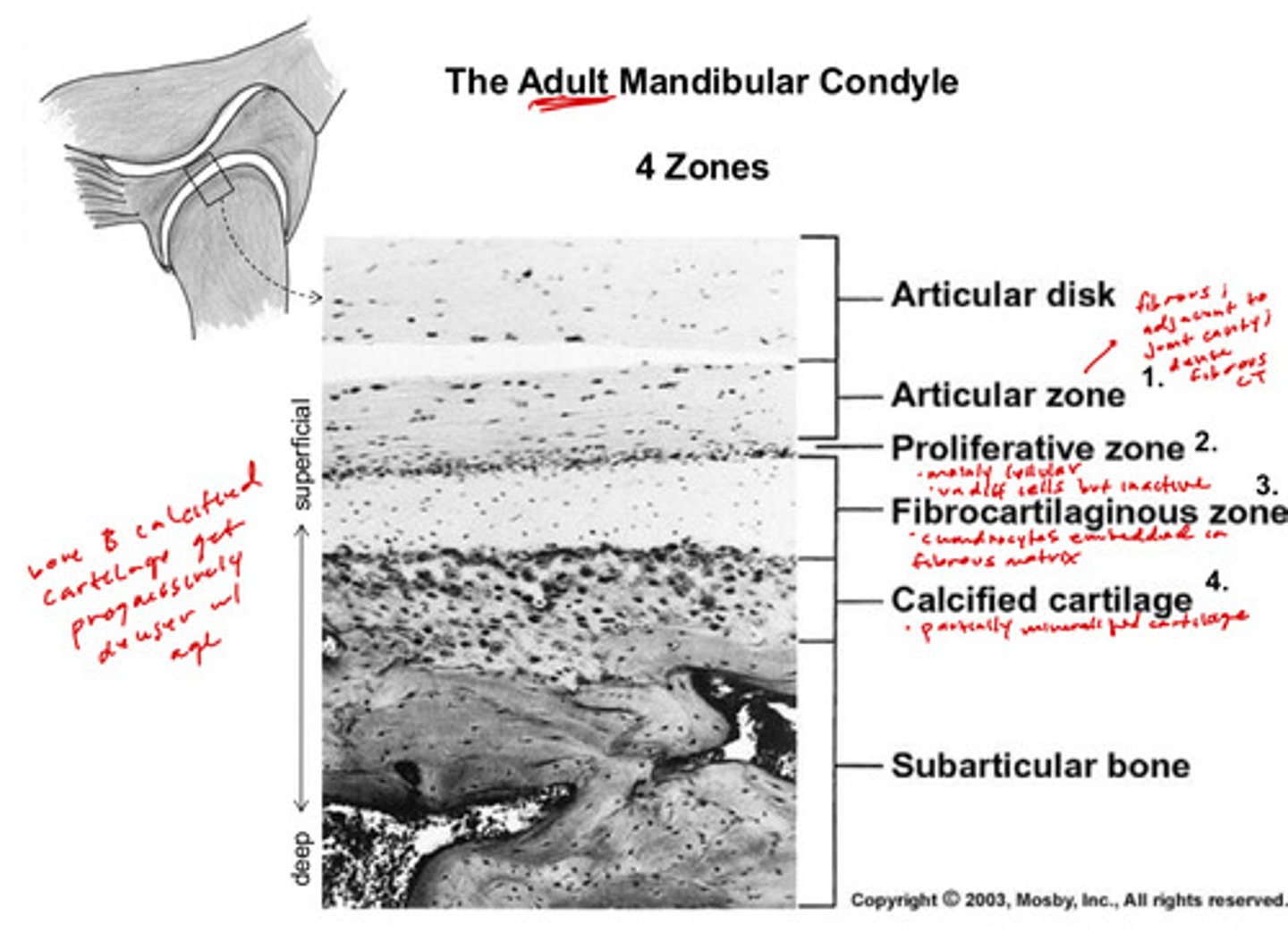 <p>first you see the articular disk with the inferior joint cavity underneath</p><p>1) articular zone: fibrous; adjacent to joint cavity; composed of dense fibrous CT</p><p>2) proliferative zone: mainly cellular; has many undifferentiated cells but in an adult, it is inactive</p><p>3) fibrocartilaginous zone: chondrocytes embedded in fibrous matrix</p><p>4) calcified cartilage: partially mineralized cartilage</p><p>and underneath is the subarticular bone</p>