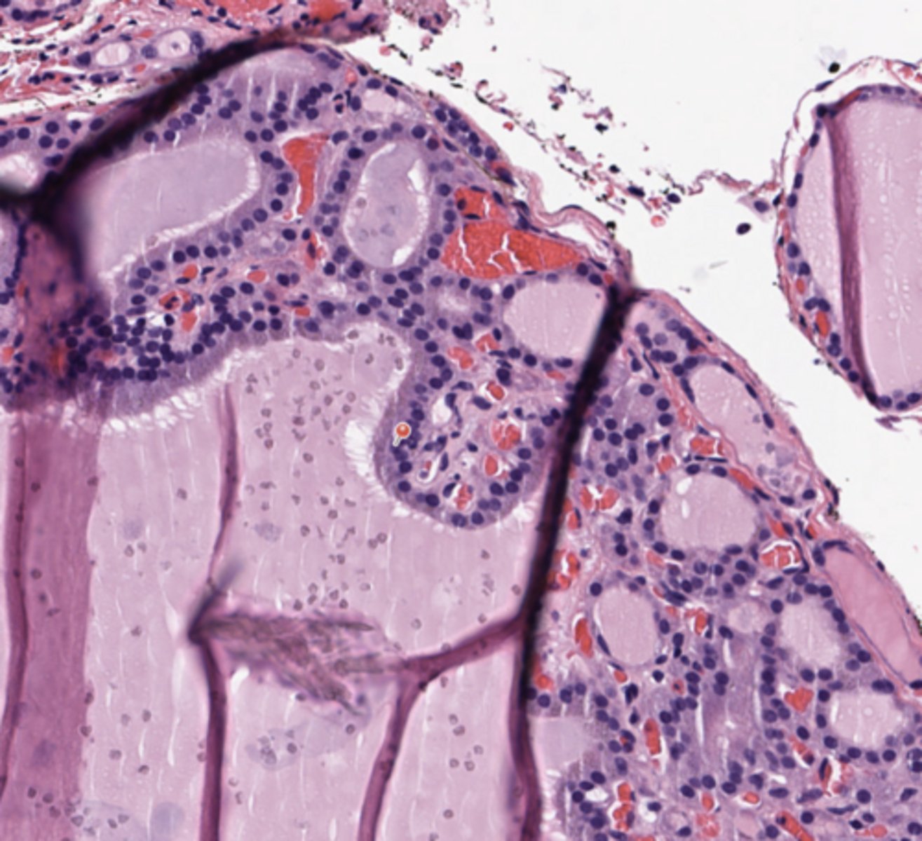 <p>Thyroid</p>