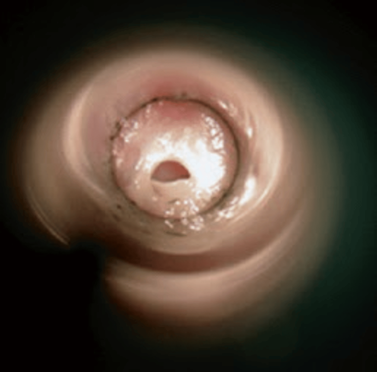 <p>The image depicts which of the following special anatomical characteristics of the chinchilla?</p><p>A. double cervix</p><p>B. freely moveable conductive apparatus</p><p>C. thin-walled tympanic bullae</p><p>D. palatal ostium</p><p>E. prominent urethral papilla</p>