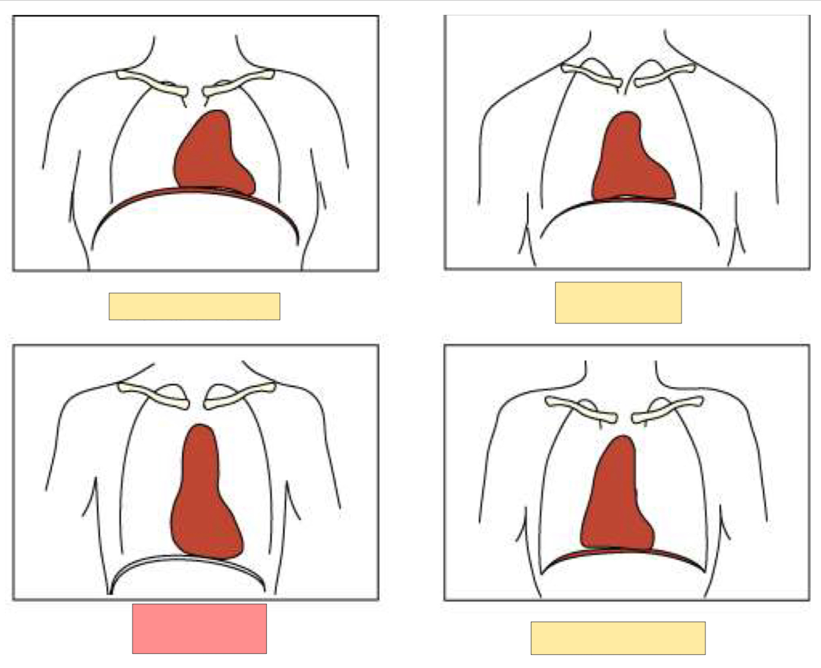 <p>What body habitus is this?</p>