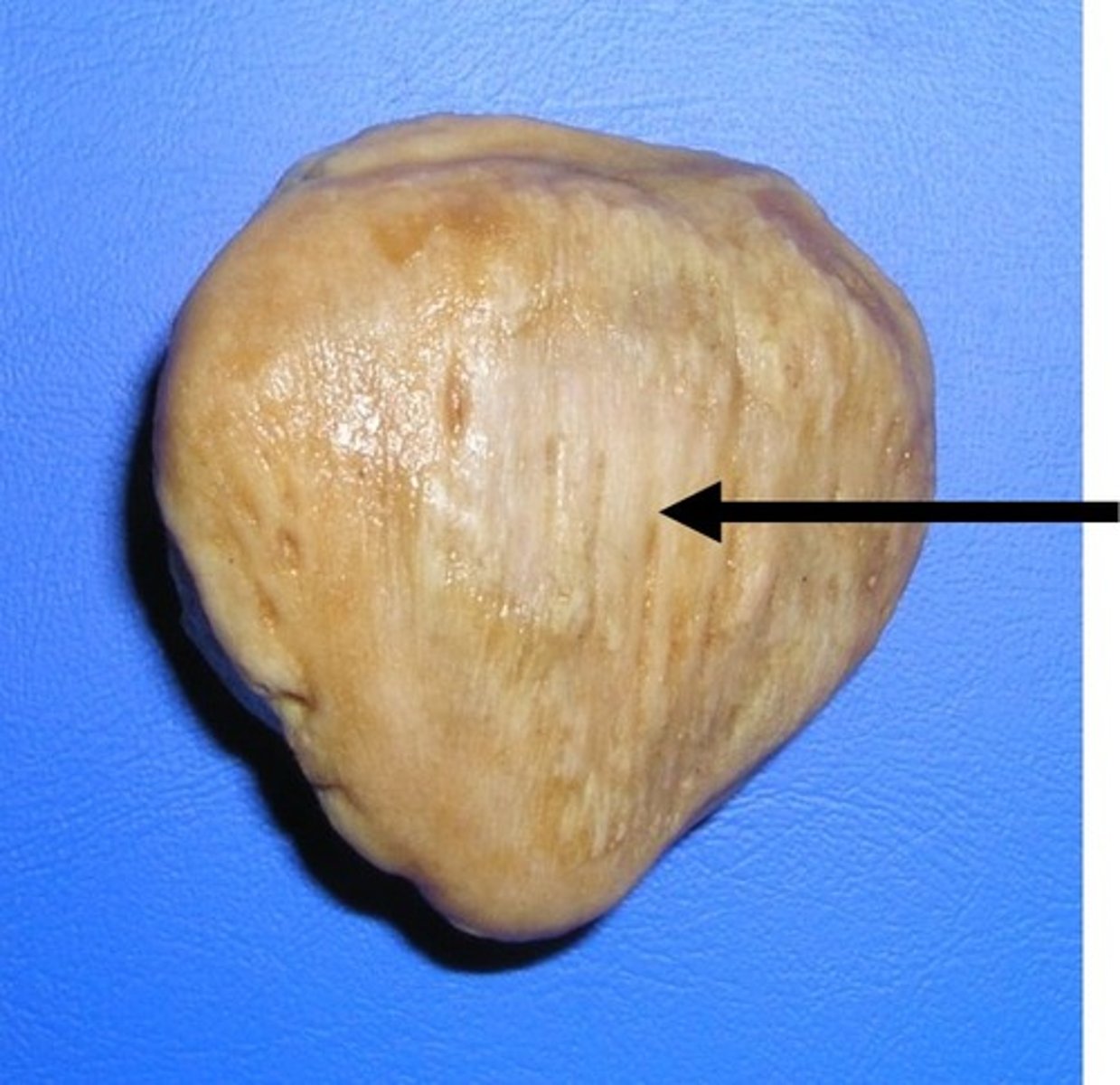 <p>convex (bump upward) and rough</p>