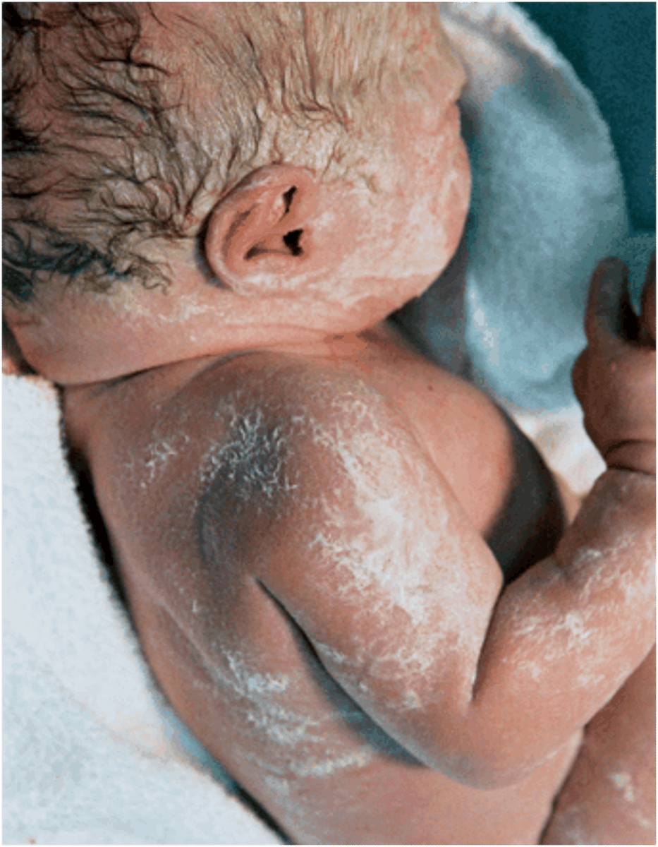 <p>A white thick cheesy material that protects the skin, made of epithelial cells and the secretions of glands.</p>