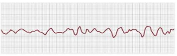 <p>What rhythm is this called?</p>