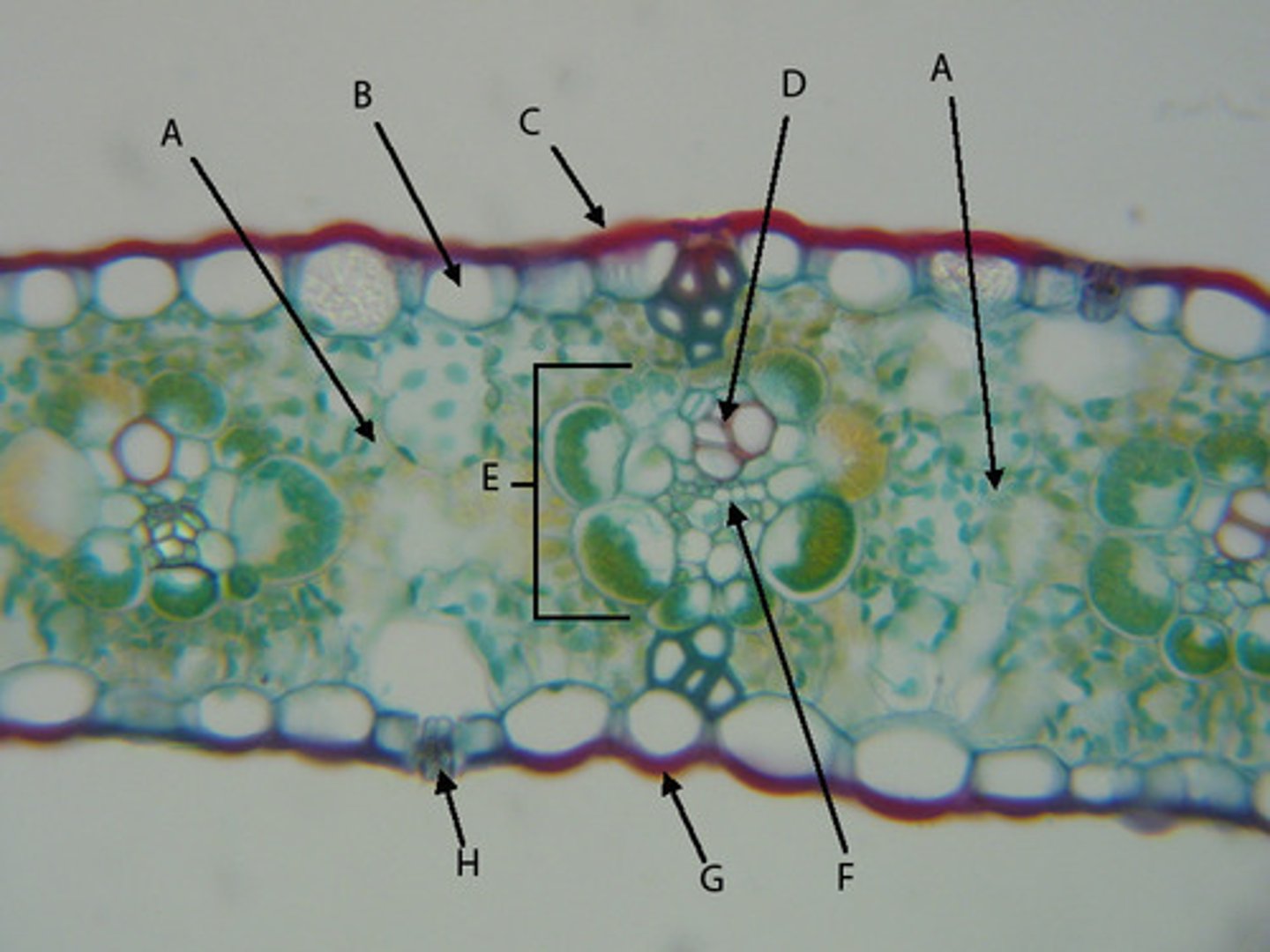 <p>Looks like a series of tight "rings" around every small vein</p>