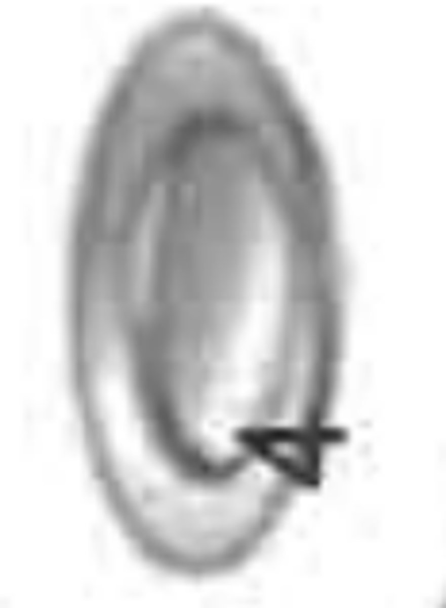 <p>flat precious metal that holds the largest host</p>