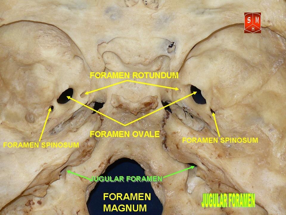 <p>CN V: Trigeminal </p>
