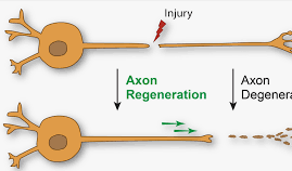 <ul><li><p>Permanent damage</p></li><li><p>Axons cannot send info at all.</p></li></ul><p></p>