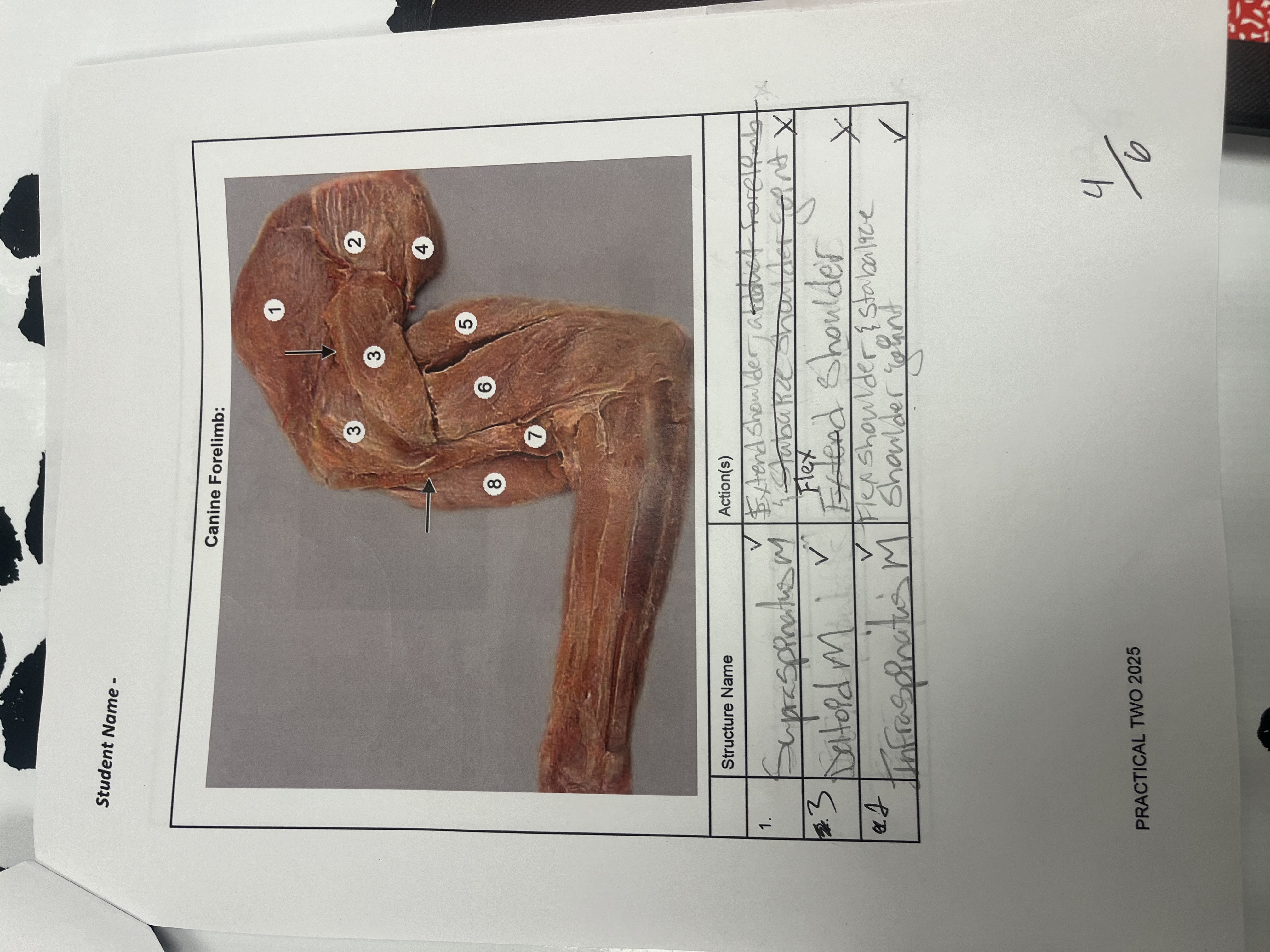 <p>Supraspinatus m. #1</p>