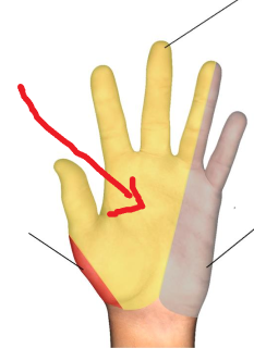 <p>The area where the red arrow is pointing is what dermatomal nerve? </p>