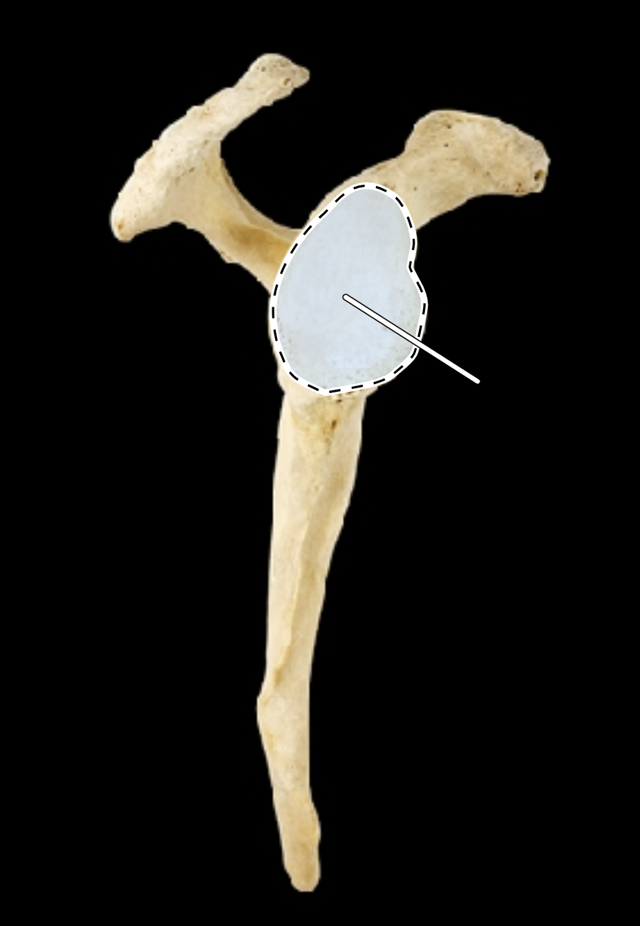 <p>Name the highlighted portion.</p><p>(Scapula, lateral view, right side).</p>