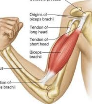 <ul><li><p>anterior arm</p></li><li><p>flexes elbow, supinates forearm</p></li></ul><p></p>