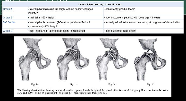 <p>Used for diagnosing LCPD</p>