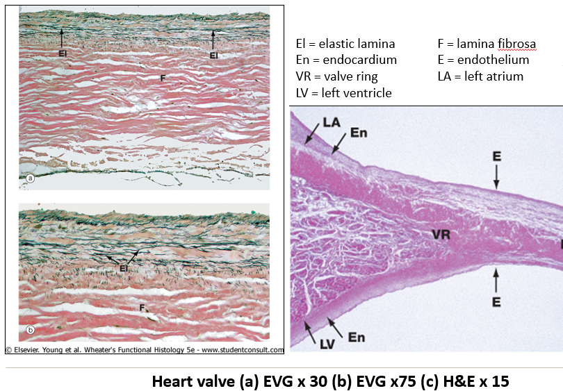 <ul><li><p><strong>Lamina fibrosa</strong> – Central <strong>collagenous plate</strong>.</p></li><li><p><strong>Elastic fibers</strong> – Prominent on the <strong>atrial surface</strong>.</p></li><li><p><strong>Covered by endocardium</strong> on both sides.</p></li></ul><p></p>